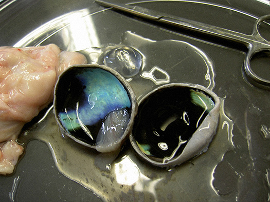Dissection of the eye